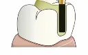 SF-EF (2).webp