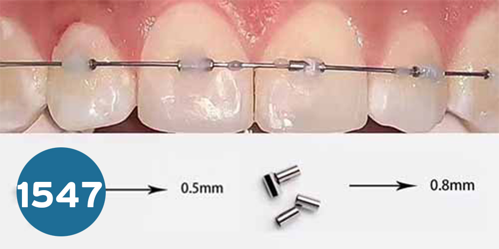 Arch wire stop استوبر تقويم