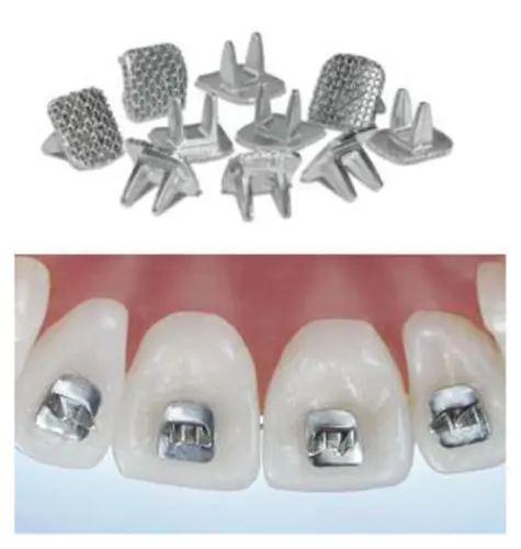 Tongue Tamers كابح لسان تقويم بالحبة 