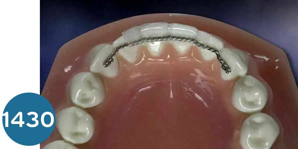 سلك تثبيت لنجوال ريتاينر برازيلي  Strands Twist Wires