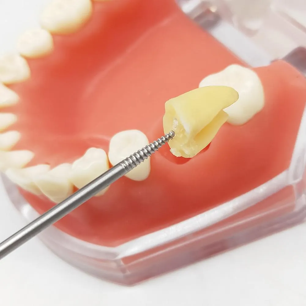 لخلع الجذور  Root Tooth Extraction Screw (نازع بقايا جذور )