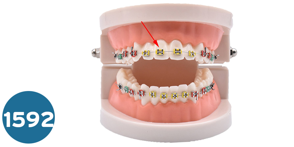 [004-0125] موديل اسنان تقويم  Orthodontic Teeth Model