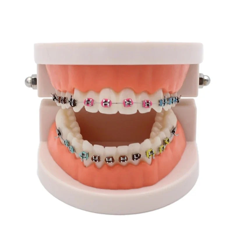 [710000000ORTH] موديل اسنان تقويم  Orthodontic Teeth Model
