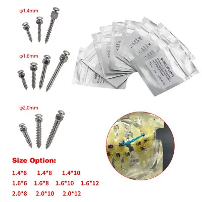 [زرعات تقويم] ميني سكرو  Orthodontic Mini Screw 10mm