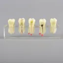 W4012 Dental Root Canal Model with Restoration ‏ موديل