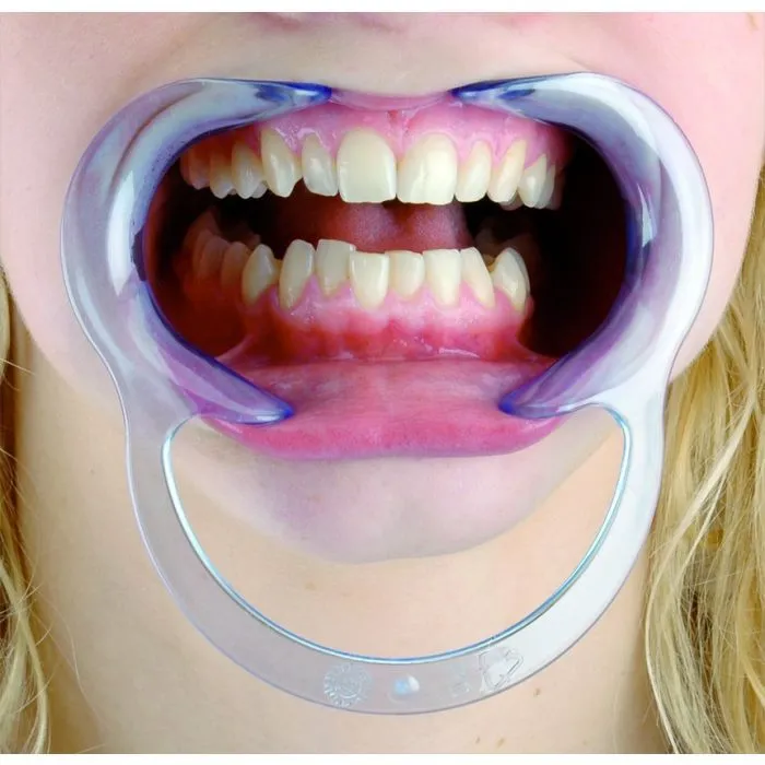 Clear Spandex Cheek and Lip Retractor فاتح فم شفاف